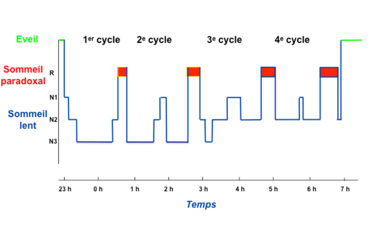 hypnogramme-2